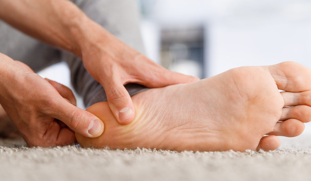 Plantar Fasciitis